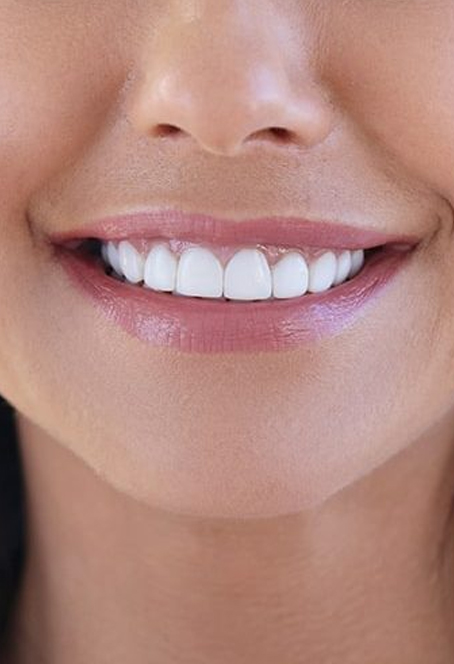 7 verbreitete Mythen über Zahnaufhellung – und was wirklich stimmt